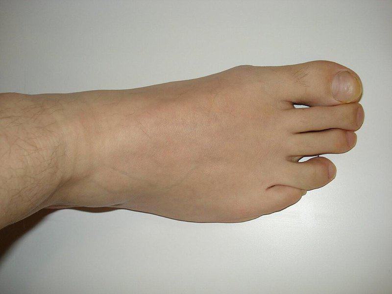 Entering With The Right Foot First